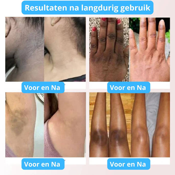 PHANSTA - Lichaam en Gezicht Scrub Gel – Diepe Reiniging en Hydratatie 50ml