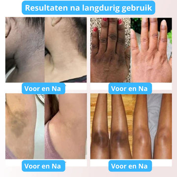 Ervaar een frisse, stralende huid!